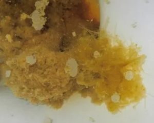 Жжение в кишечнике, жёлтый стул