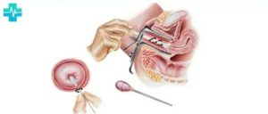 Может ли беременная отказаться от взятия мазков