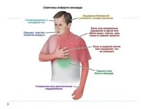 Около месяца беспокоит аритмия. Сопровождается обильной отрыжкой воздухом