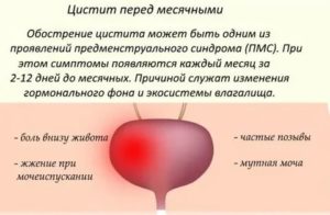 Рези при мочеиспускании за несколько дней перед месячными