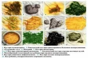 Стул черного цвета у ребенка 6 мес