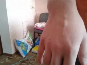 Шарик на вене