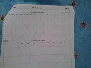 Расшифруйте холтер пожалуйста