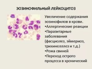 Повышены эозинофилы в носу