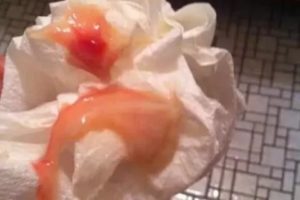 Бежевые выделения во 2 триместре беременности