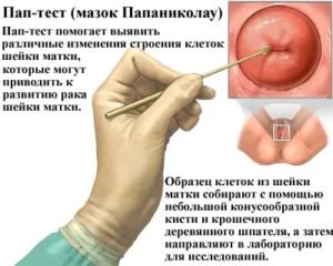 Может ли беременная отказаться от взятия мазков