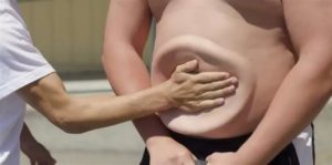 Удар по животу