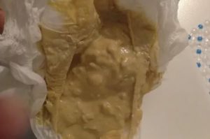 Жидкий стул полгода