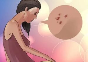 Папиллома при беременности