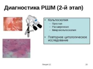 Плохая цитология и хороший кольпоскопия