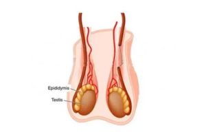 Периодические кровотечения из мошонки