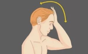 Головокружение при наклонах головы и поворотах