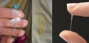 Белые выделения, но не молочница