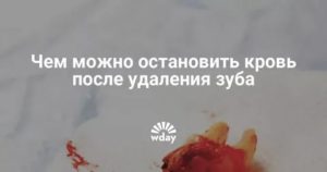 Удалили зуб. То сих пор есть примесь крови в слюне