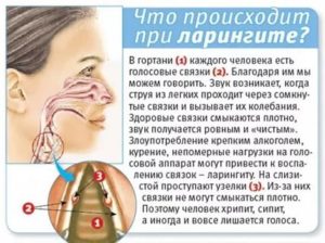 При разговоре пропадает голос