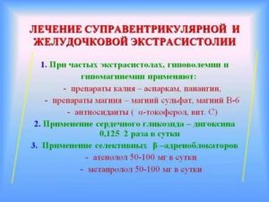 Лечение экстрасистолии