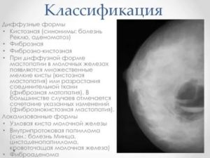 Фиброзно кистозная мастопатия, болезнь Минца