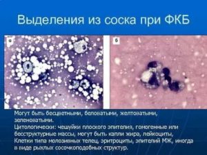 Бесструктурное вещество, макрофаги