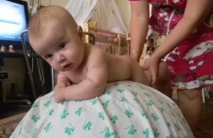 Вентрикулодилатация и не держит голову в 3 месяца