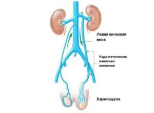 Периодические кровотечения из мошонки