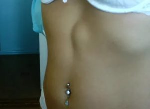 Шишка на животе