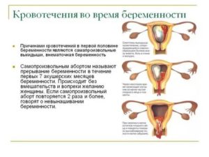 Кровотечение на протяжении месяца