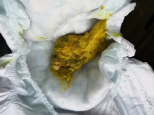 Стул черного цвета у ребенка 6 мес