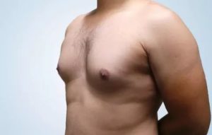 Увеличен сосок