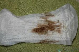 Месячные 2 дня шли и появилась потом мазня