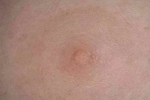 Светлый набухший ореол. Алый сосок