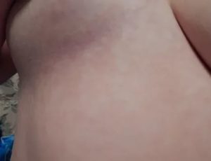 Зуд и покраснение в ложбинке груди