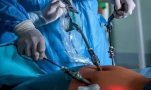 Лапароскопия, Гистероскопия и беременность после