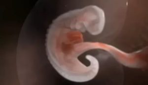 Токсикоз на 5 неделе