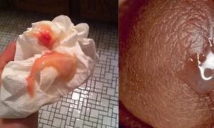 Месячные 2 дня шли и появилась потом мазня