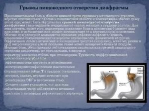 Боль под мечевидным отростком