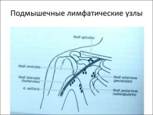 Подмышечные лимфатические узлы