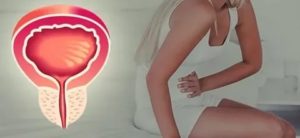 Рези при мочеиспускании за несколько дней перед месячными