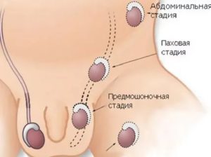 Сдавили одеждой яички ребенку