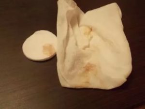 Бежевые выделения во 2 триместре беременности