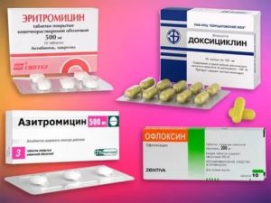 Антибиотики после гистероскопии