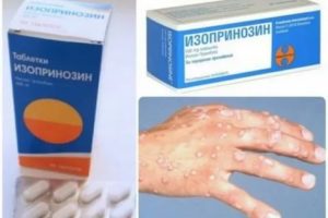 Изопринозин высыпания на коже