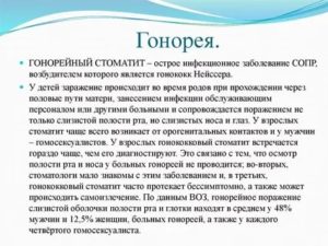 Гонорея во рту