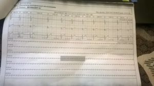 Расшифруйте холтер пожалуйста