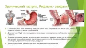 Рефлюкс эзофагит 1степени, поверхностный гастрит и деуденит