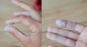 Белые выделения, но не молочница