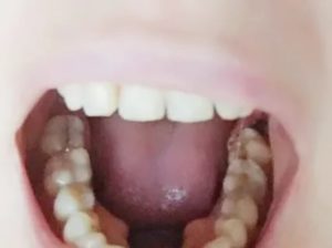 После удаления 8 ки