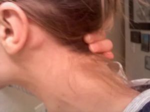 Стук и боли в ухе, кажется увеличены лимфоузлы