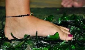 Стекло в ноге