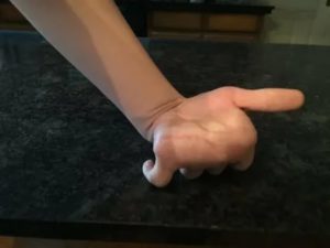 Руку выворачивает