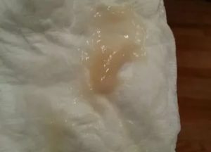 Бежевые выделения во 2 триместре беременности